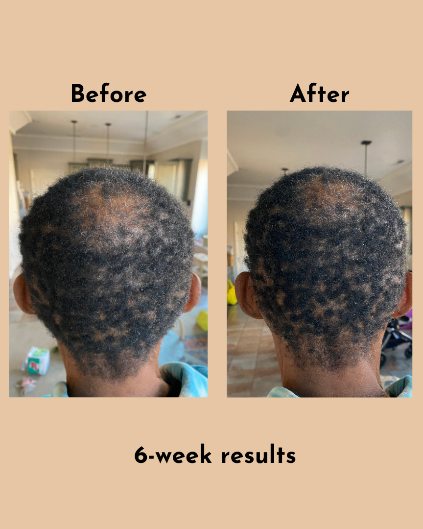 GoGrow Hair Elixir