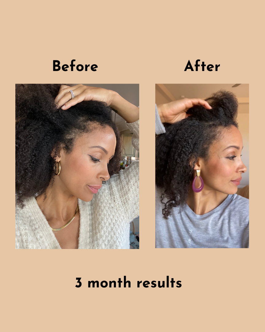 GoGrow Hair Elixir
