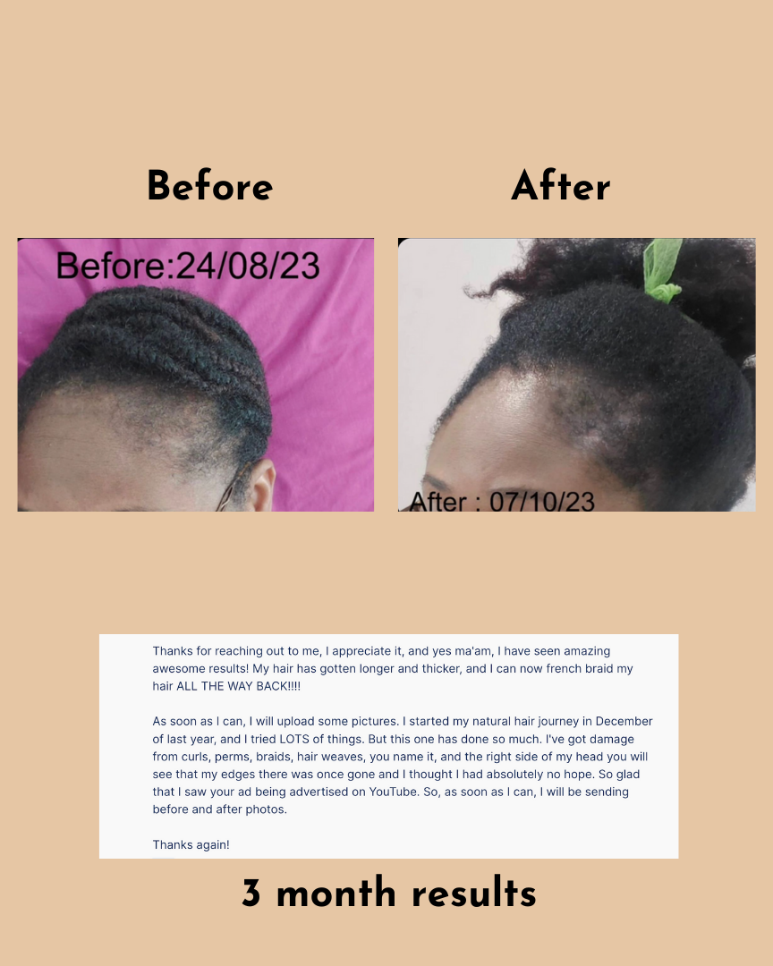 GoGrow Hair Elixir
